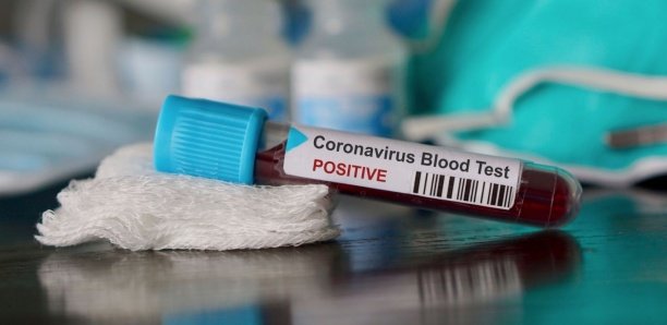 Coronavirus au Sénégal : L’Anglaise testée positive est une employée de l’Onu