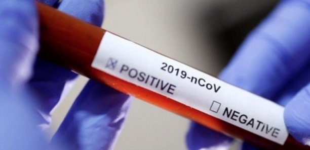 Coronavirus : Un agent du Groupe Futurs Médias déclaré positif