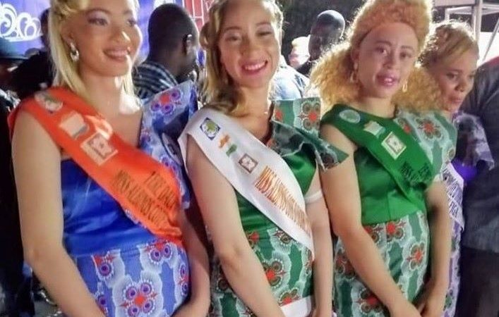 Côte d’ivoire: Miss Albinos 2020, une reine de beauté comme les autres