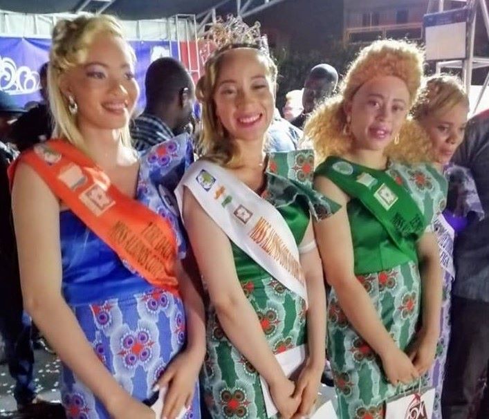 Côte d’ivoire: Miss Albinos 2020, une reine de beauté comme les autres