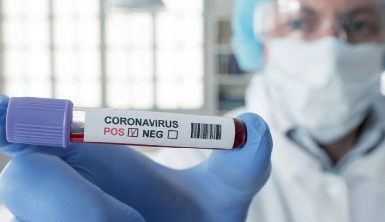 Coronavirus : Les cas asymptomatiques sont « porteurs d’une même quantité de virus »