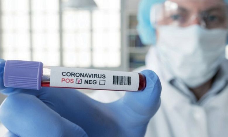 Coronavirus : Les cas asymptomatiques sont « porteurs d’une même quantité de virus »