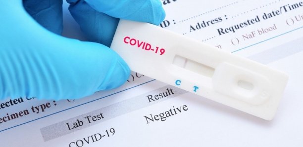 Covid-19 : 2 décès, 733 nouveaux cas positifs et 19 patients en réa