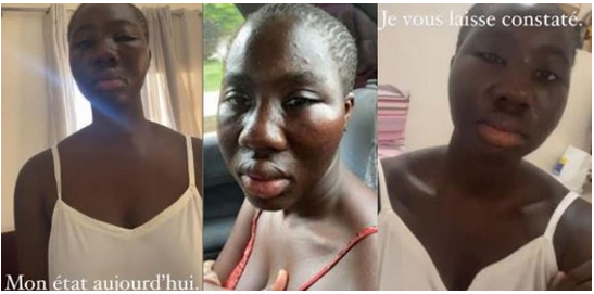 Agression sexuelle présumée : Kaliphone, la mannequin Adji Thiare Diaw et les « coups et morsures »