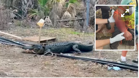 Un homme mordu par un alligator dans un étang de Floride